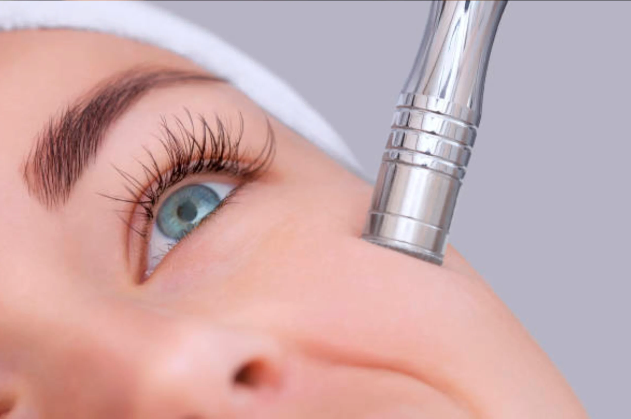 Microdermabrasion treatment
